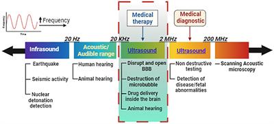 Therapeutic ultrasound: an innovative approach for targeting neurological disorders affecting the basal ganglia